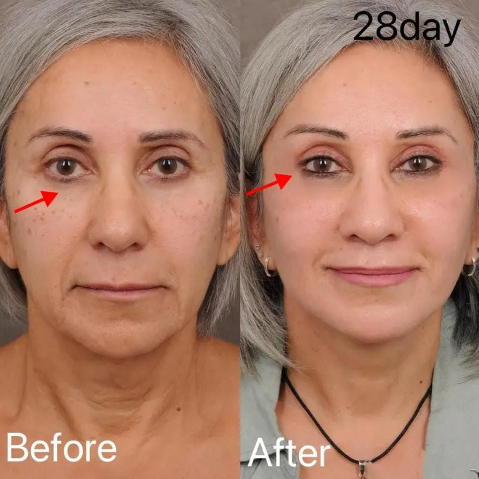 KORMESIC KOJIC Acid__Eye Cream