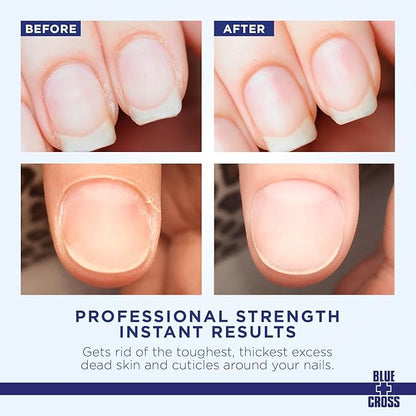 Blue+Cross Cuticle Remover Nail & Cuticle Care Treatment.