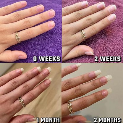 Nail Growth Oil  ( Cuticle Oil ) Nail Nutrition Care / Born Pretty Cuticle oil